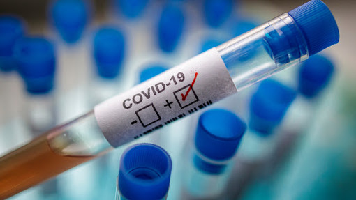 Coronavirus, in provincia di Varese 298 contagi. In Lombardia sono 3.120, in Italia 18mila