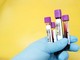 Direzione Welfare Lombardia: «Tutte le varianti del Covid sono efficacemente coperte a ciclo vaccinale completato»